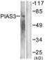 PIAS3 Antibody (aa10-59)